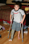 Grant on Crutches