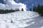 Bumps Galore!